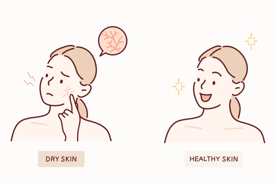 乾燥して肌がカサカサ！　体を温めて血めぐりをよくしよう